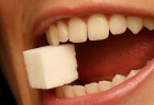 9 Nguyên nhân gây sâu răng phổ biến