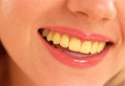 Nguyên nhân nào khiến răng bị vàng ố