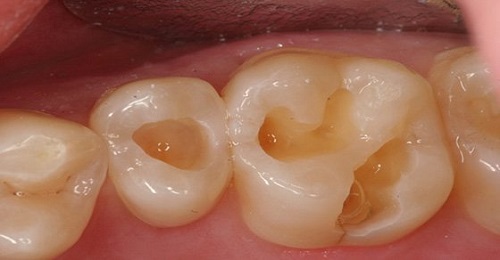 Các bệnh lý ở răng miệng 1