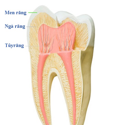 Nguyên nhân và cách điều trị viêm tủy răng 1