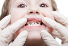 Sâu răng sữa sớm: Mối nguy hiểm cha mẹ không hề biết